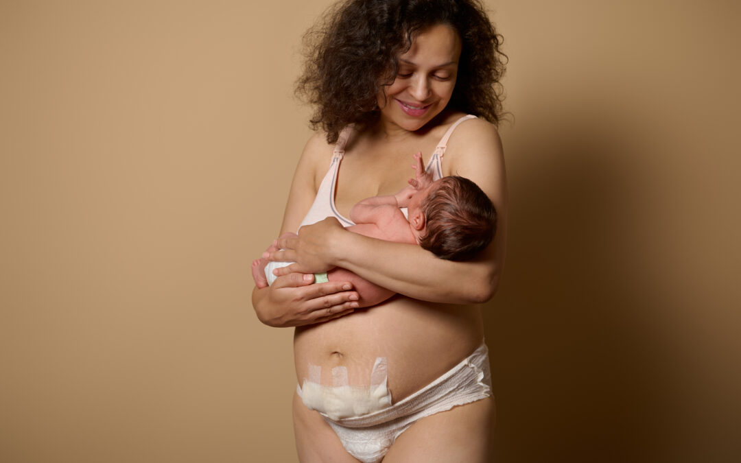 C-Section Scar Massage: Why Every Mom Should Try It & How to Get Started for Better Healing