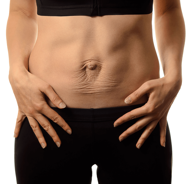postpartum mom showing her diastasis recti abdomen and receiving guidance with postpartum trainer beth colucci foppiano